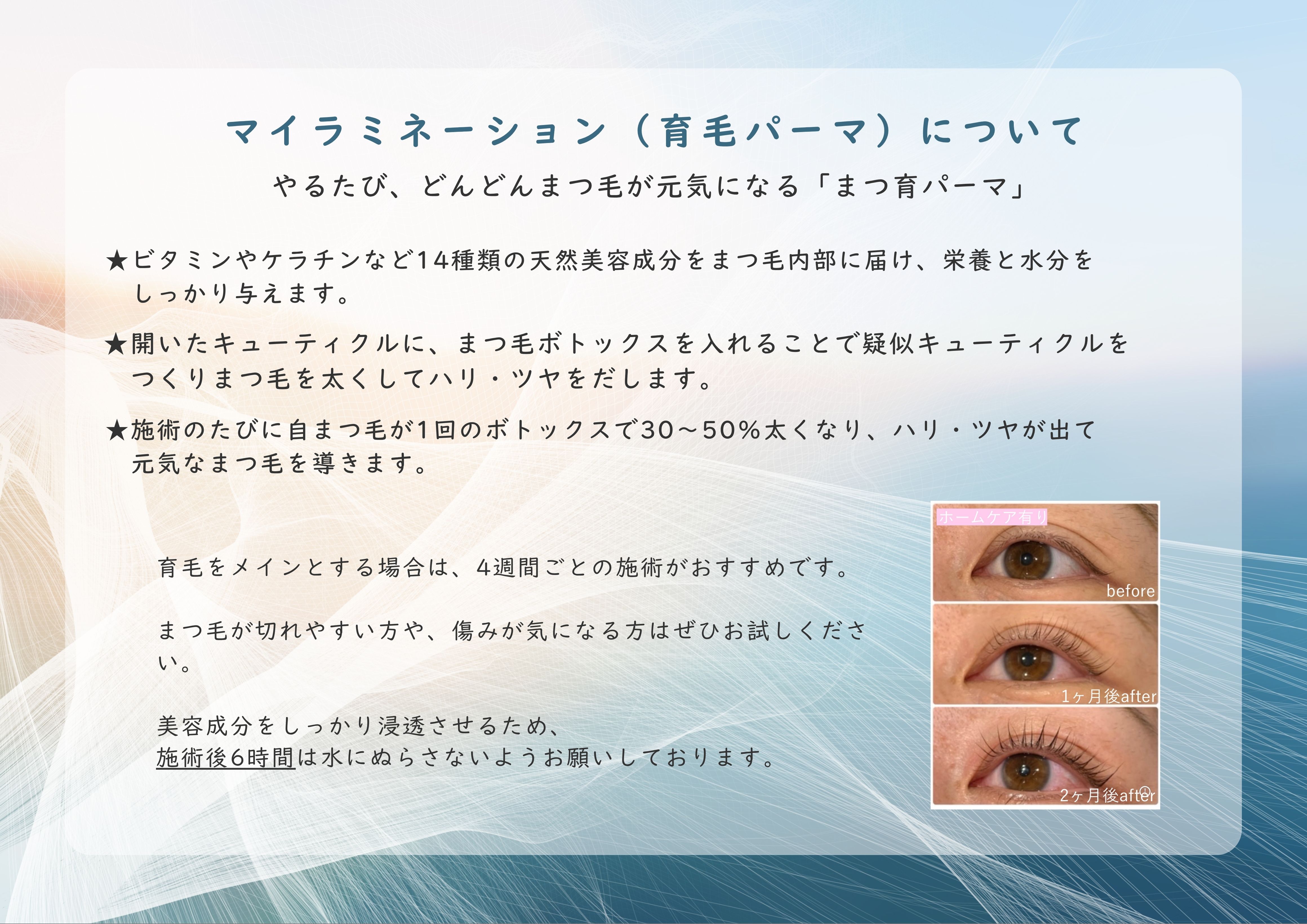 マイラミネーション説明